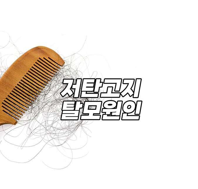 저탄고지 탈모