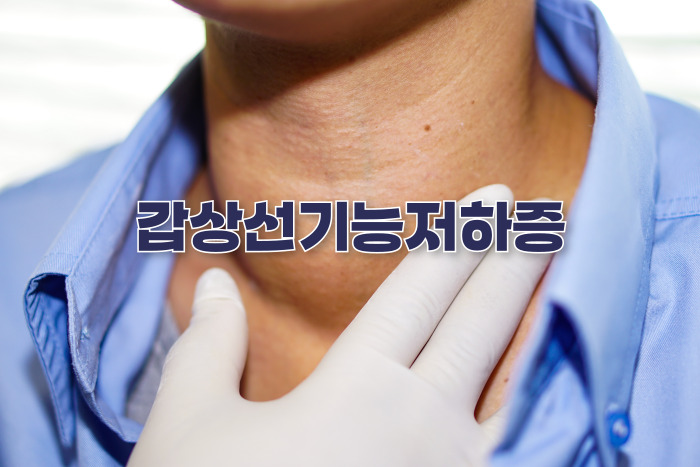 갑상선기능저항증 다이어트